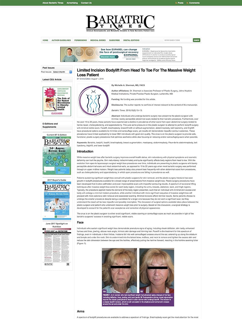 Bariatric surgery informative article and patient imagery.