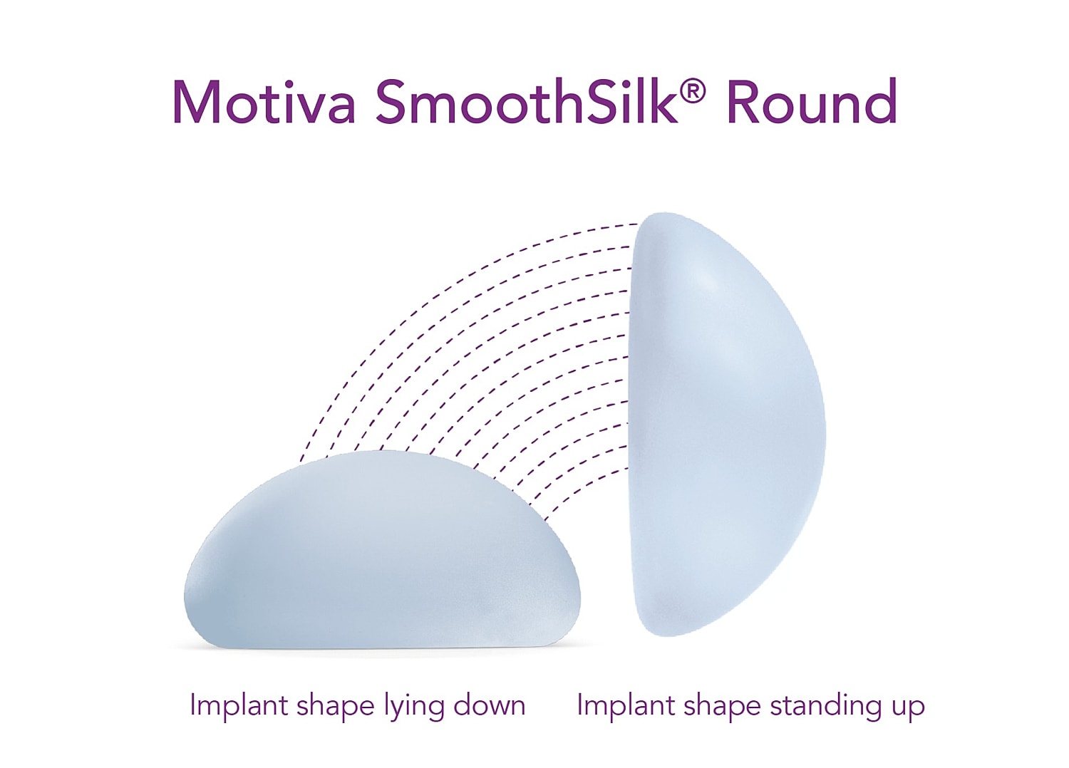 Motiva SmoothSilk Round implant shapes illustrated.